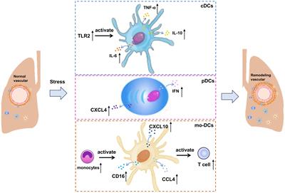 The role of immune cells in the pathogenesis of connective tissue diseases-associated pulmonary arterial hypertension